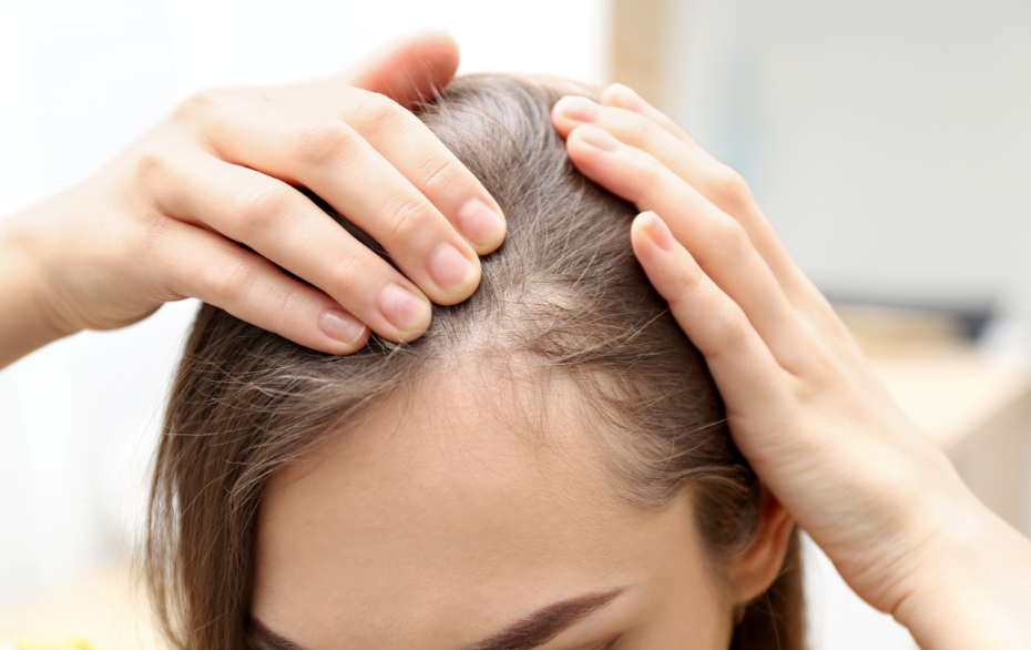 female hair loss treatment in Sydney